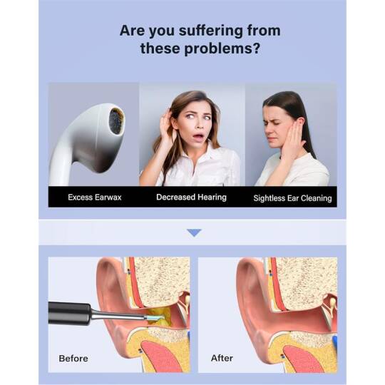 BEBIRD T5 3MP KAMERA 3.5MM LENS ŞARJLI WIFI GÖRÜNTÜLÜ KULAK TEMİZLEYİCİ SİYAH RENK - 11