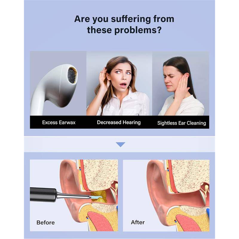 BEBIRD T5 3MP KAMERA 3.5MM LENS ŞARJLI WIFI GÖRÜNTÜLÜ KULAK TEMİZLEYİCİ SİYAH RENK - 3